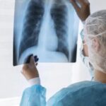 Tuberculosis